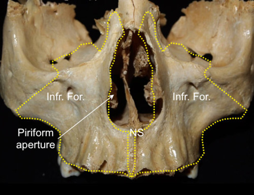 Nasal anatomy and osseous relantionships